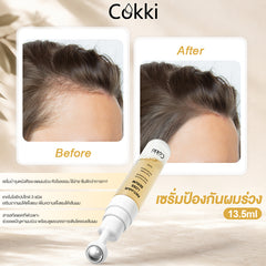 เซรั่มป้องกันผมร่วง 13.5ml