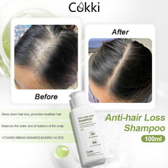 Anti-hair Loss Shampoo 100ml