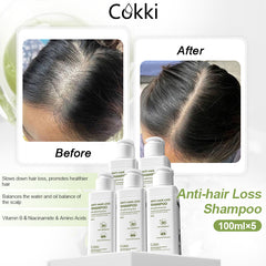 Anti-hair Loss Shampoo 100ml*5