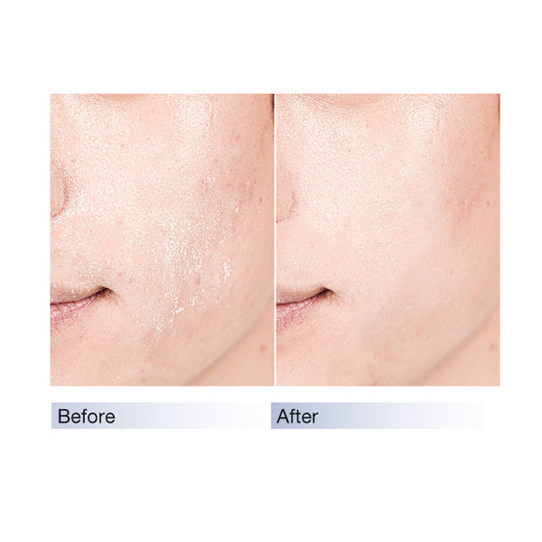 Highly Moisturizing Pad 100pads