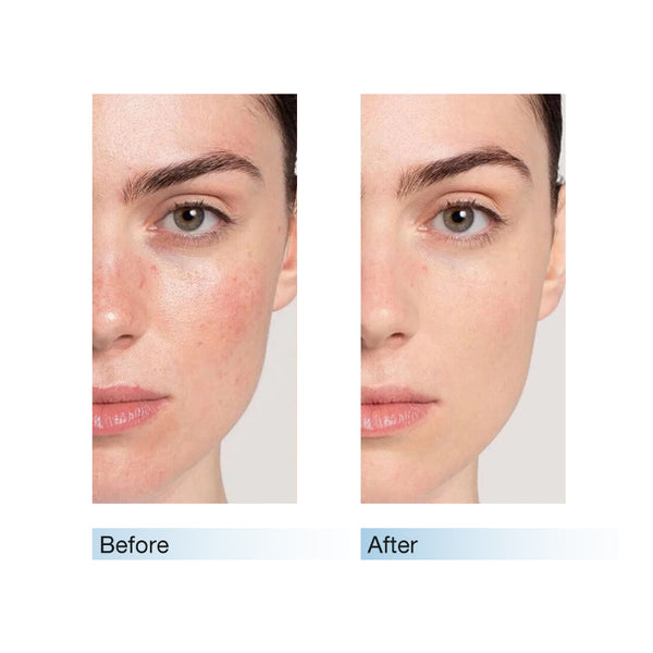 Centella Soothing Daily Mask 30sheets