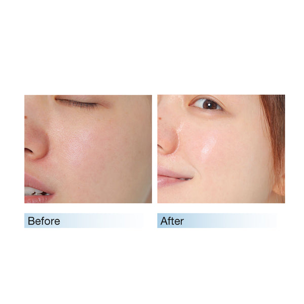 Soothing Moisturizer Cream 80g