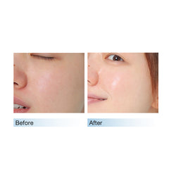 Soothing Moisturizer Cream 80g