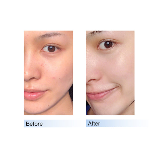 Hydrating Gentle Cleansing Foam 150g+20g