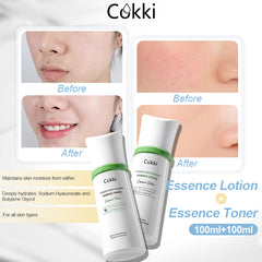 [Limited-time Offer]Tender Moisturizing Essence Lotion&Toner