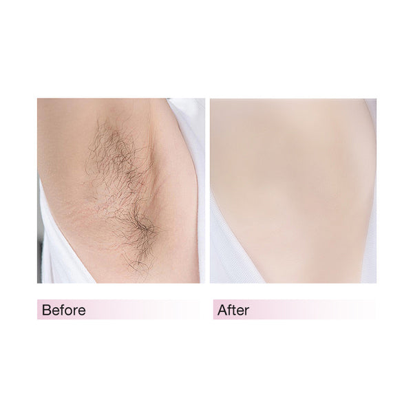 Hair Removal Spray 100ml