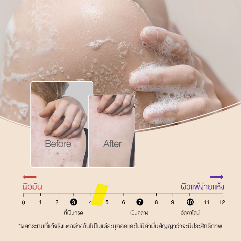 ขนาดใหญ่สุดคุ้ม 900 ml Cokki ครีมอาบน้ำ พีเอช 5.5 ที ทรี เจลอาบน้ำ Tea Tree Naturally Clear Skin Mild & Deep Clean Body Wash